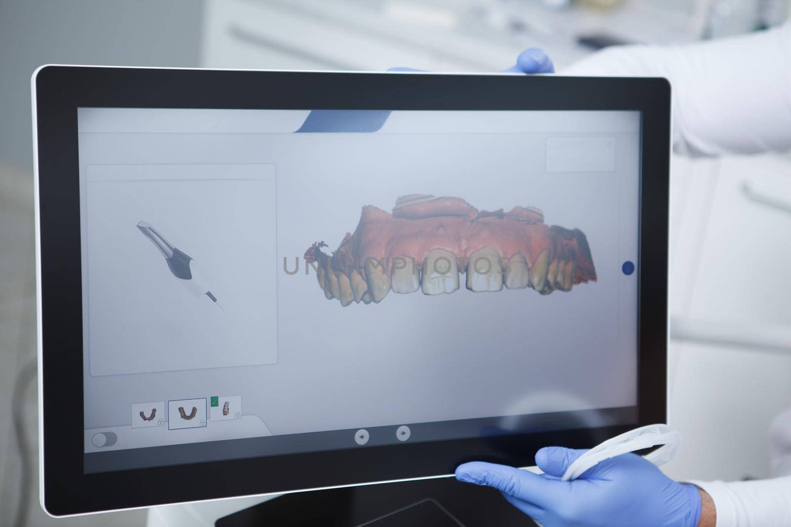 Dentist using dental scanner on patient by MAD_Production