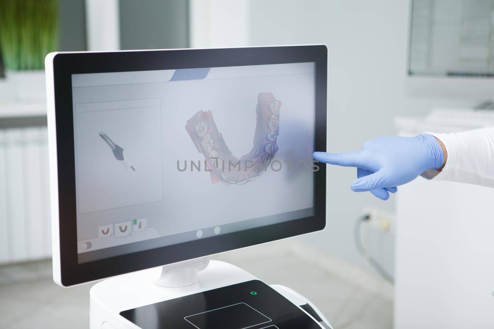 Dentist pointing at dental scan on computer screen
