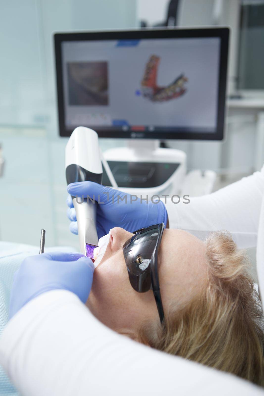 Vertical close up of a female patient having dental scanning done by her dentist