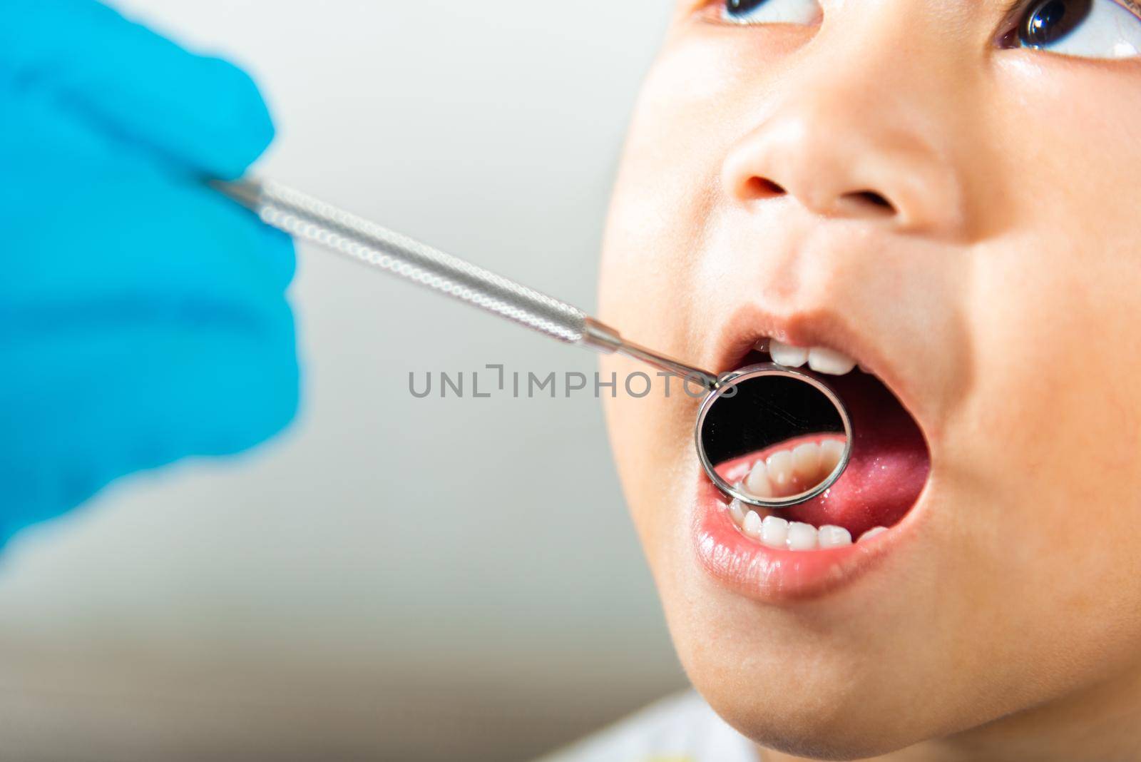 Doctor examines oral cavity of little child uses mouth mirror to checking teeth cavity by Sorapop