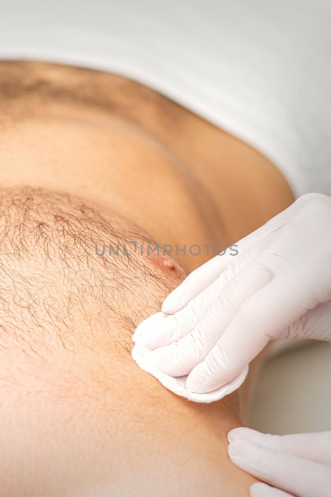 Young caucasian man receiving hair removal from his chest in a beauty salon, depilation men's torso