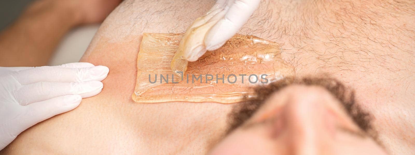 Young caucasian man receiving hair removal from his chest in a beauty salon, depilation men's torso