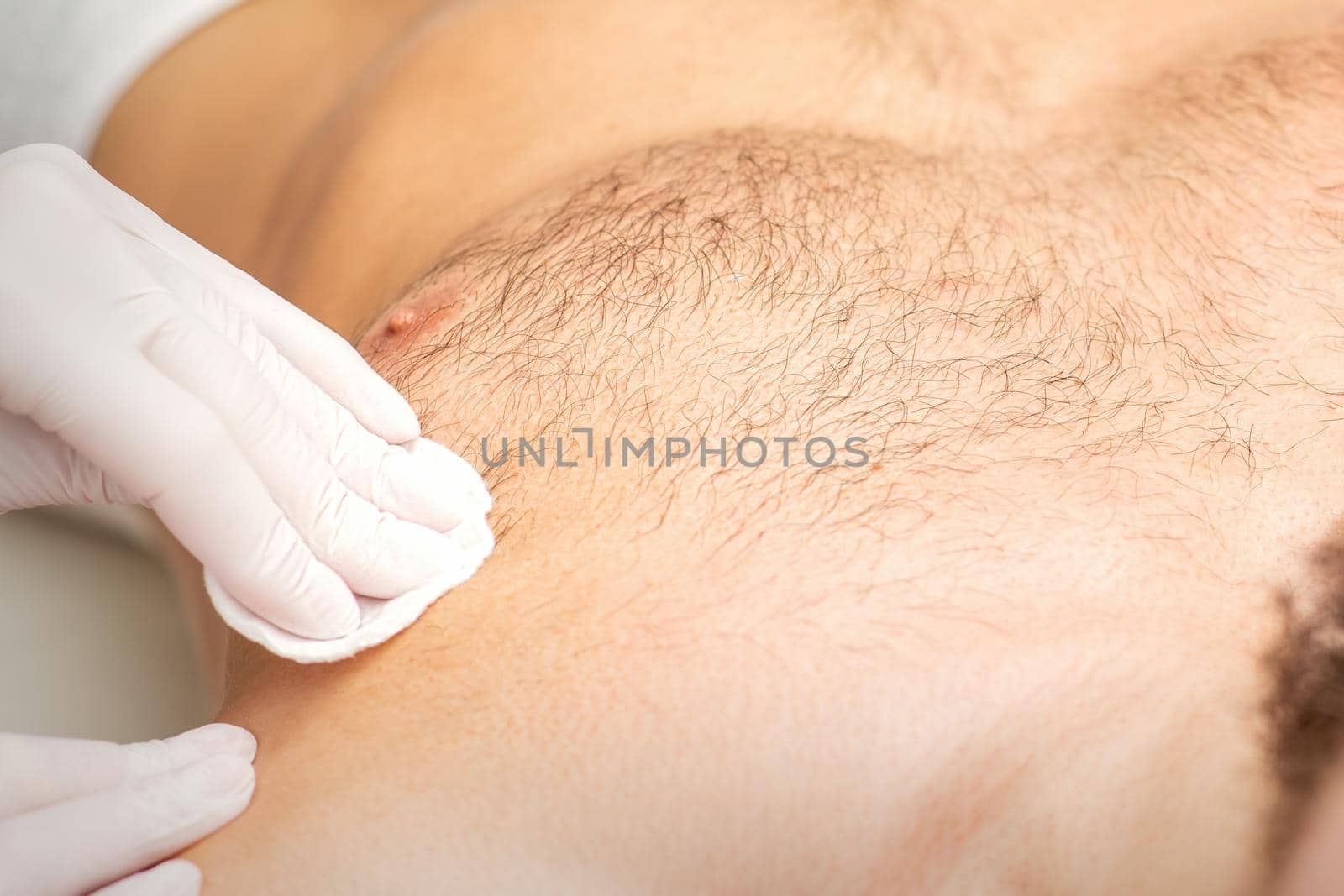 Young caucasian man receiving hair removal from his chest in a beauty salon, depilation men's torso