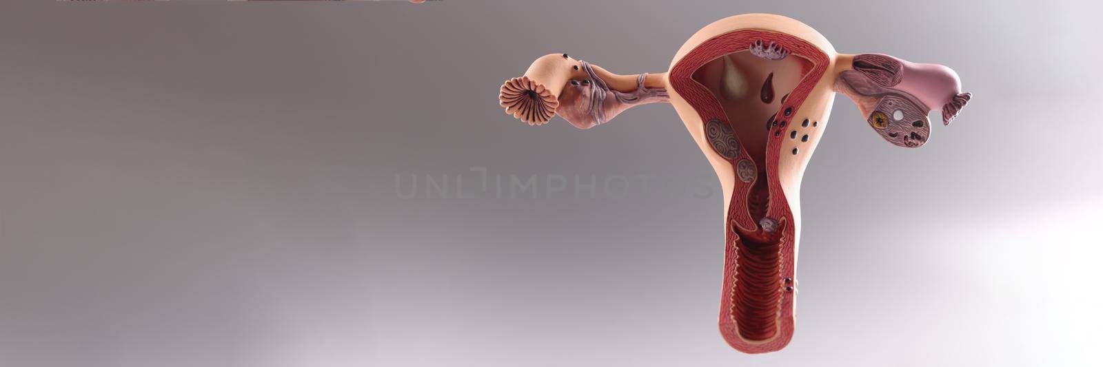 Closeup of artificial plastic model of uterus and ovaries on gray background by kuprevich