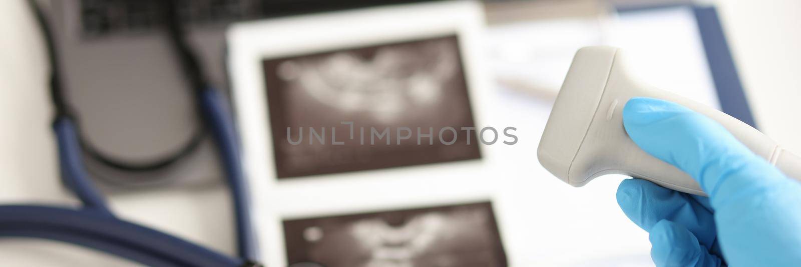 Doctor holding ultrasound probe against background of pictures and medical documents closeup. Instrumental diagnostics in medicine concept