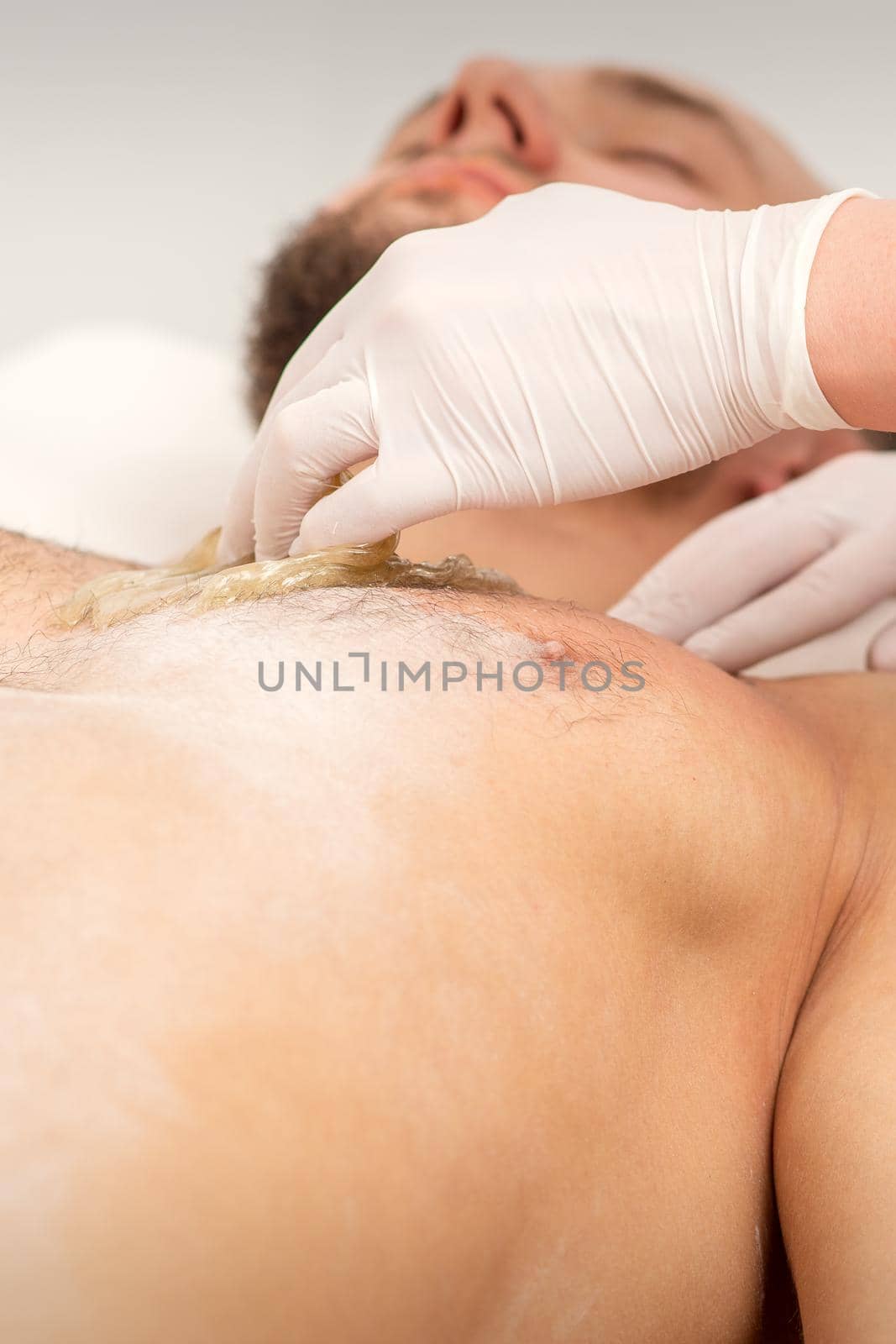 Epilation chest of a young male with the liquid wax paste in a beauty salon