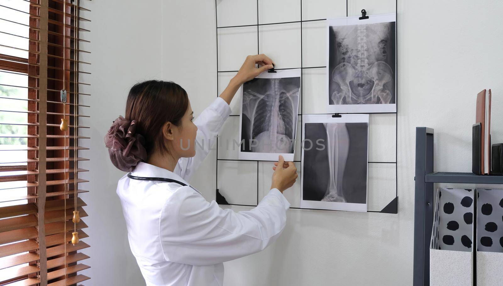 Doctor showing x-ray result to patient in clinic..