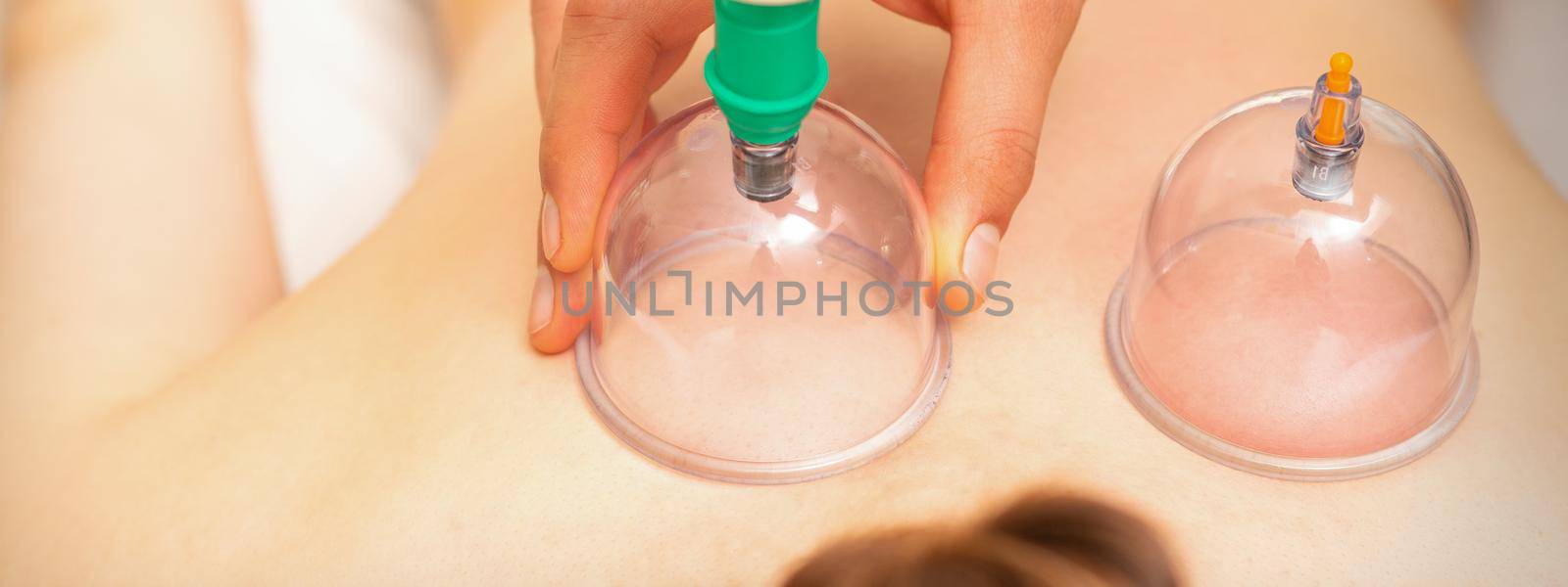 Woman receiving vacuum cupping treatment on back laying on the chest in massage salon