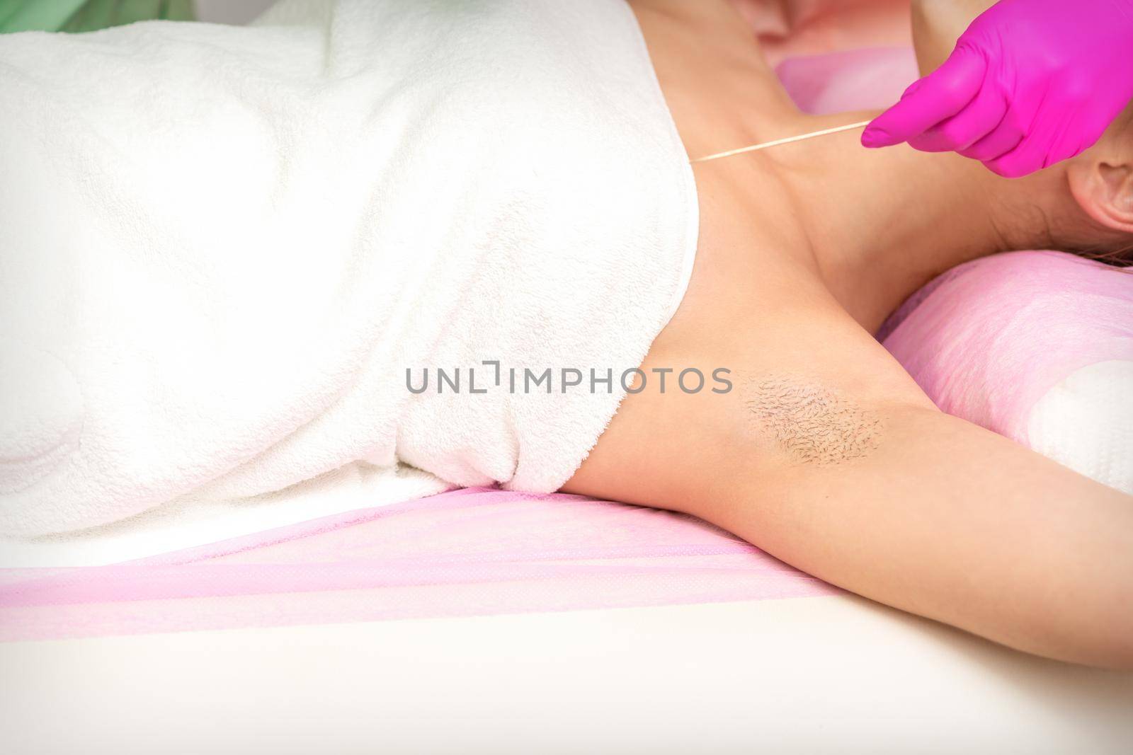 Hand in glove with spatula depilates female hairy armpit in a spa