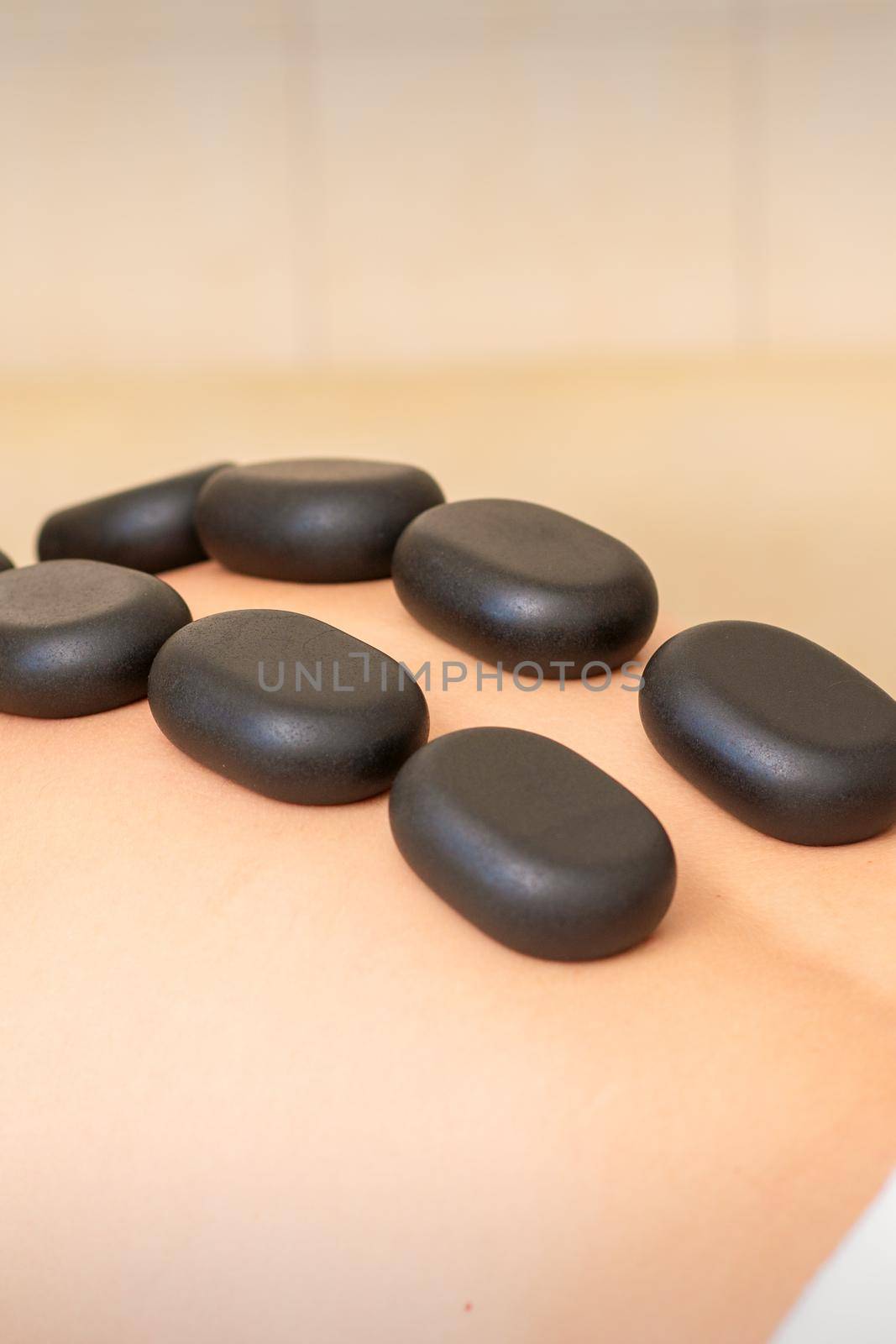 Hot stone massage therapy. Caucasian young man getting a hot stone massage on back at spa salon