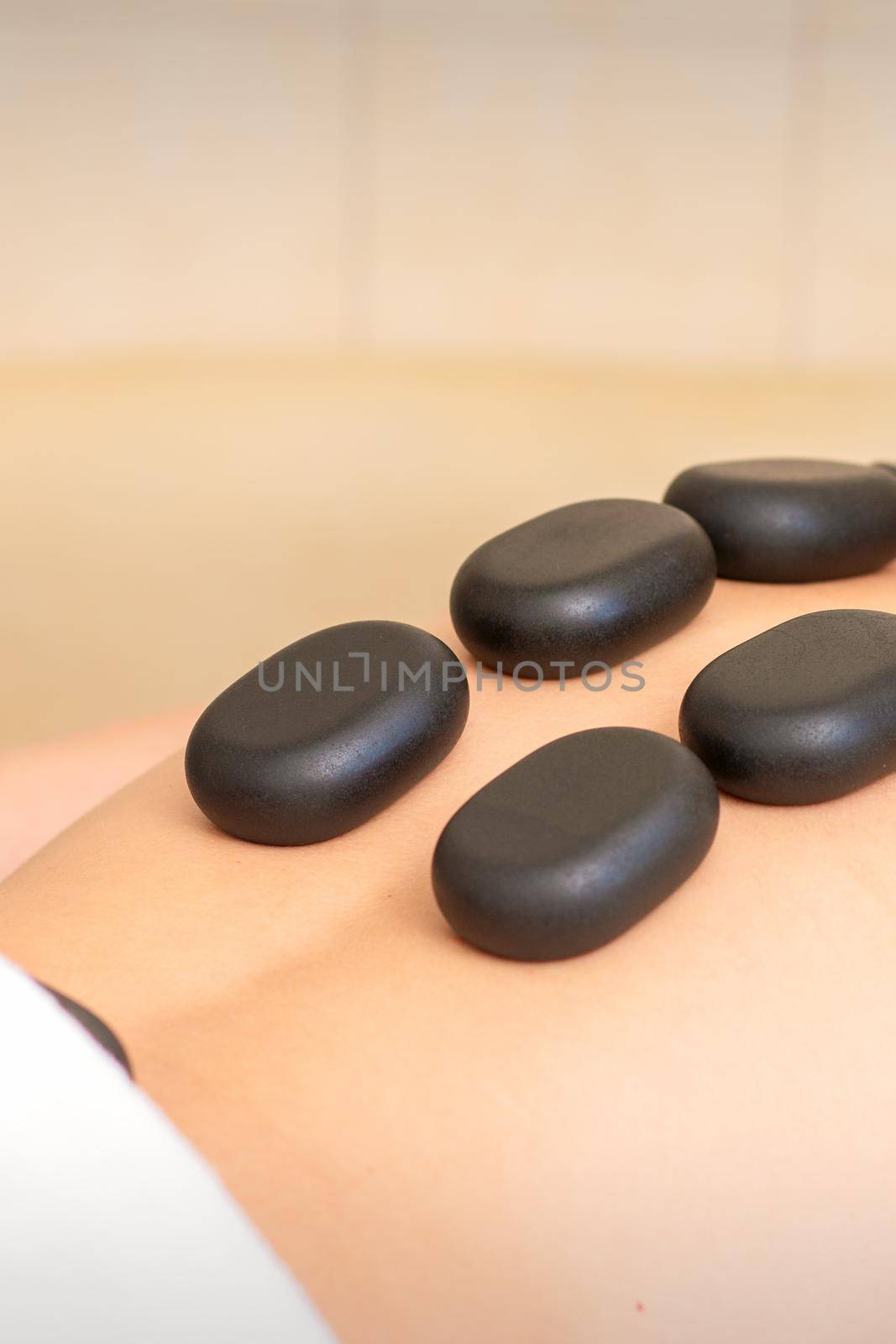 Hot stone massage therapy. Caucasian young man getting a hot stone massage on back at spa salon. by okskukuruza