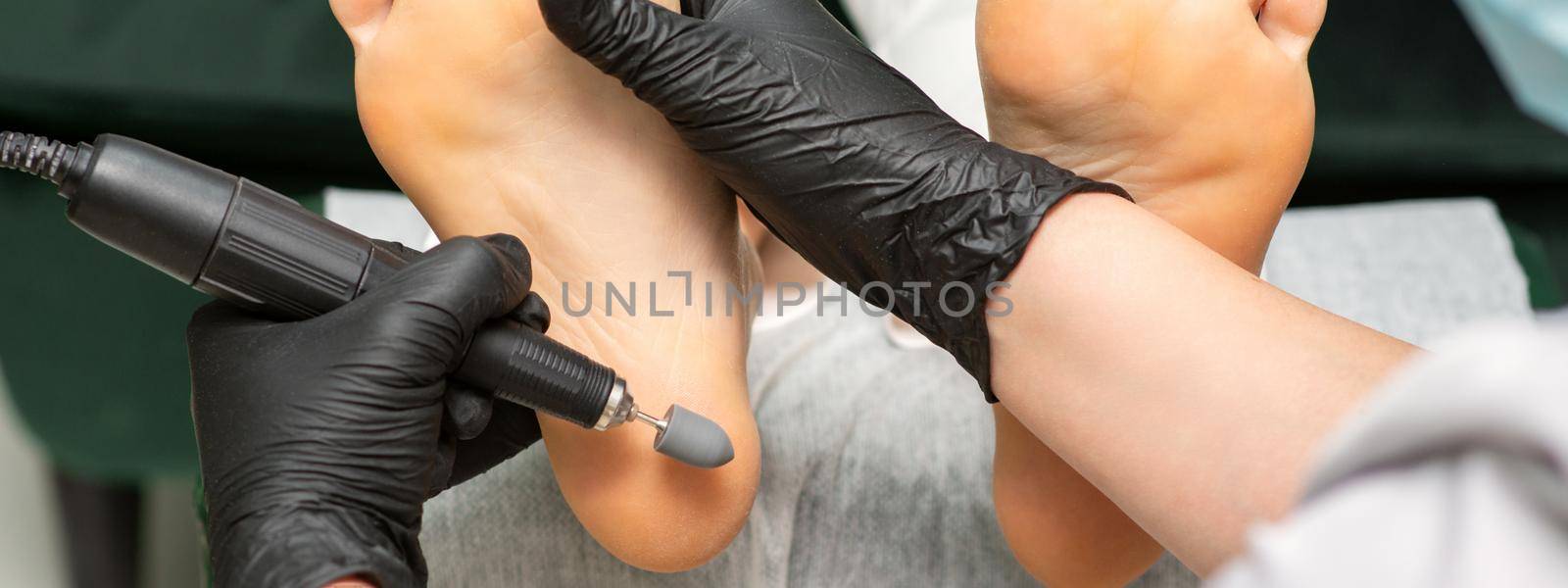 Peeling female feet. Hands of podiatry specialist in black gloves using special grinding equipment polish female foot from callus and corn in the beauty salon. by okskukuruza