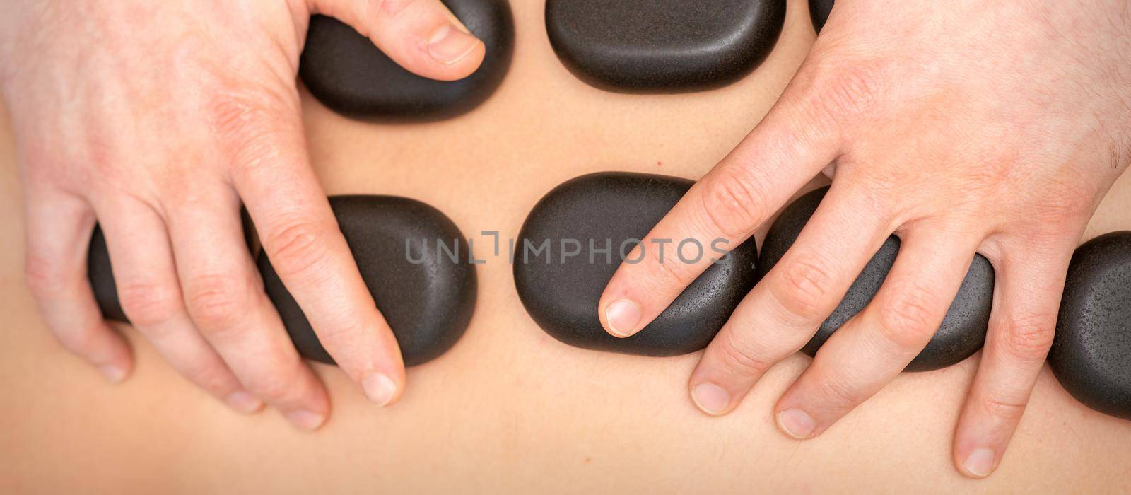 Hot stone massage therapy. Caucasian young man getting a hot stone massage on back at spa salon. by okskukuruza