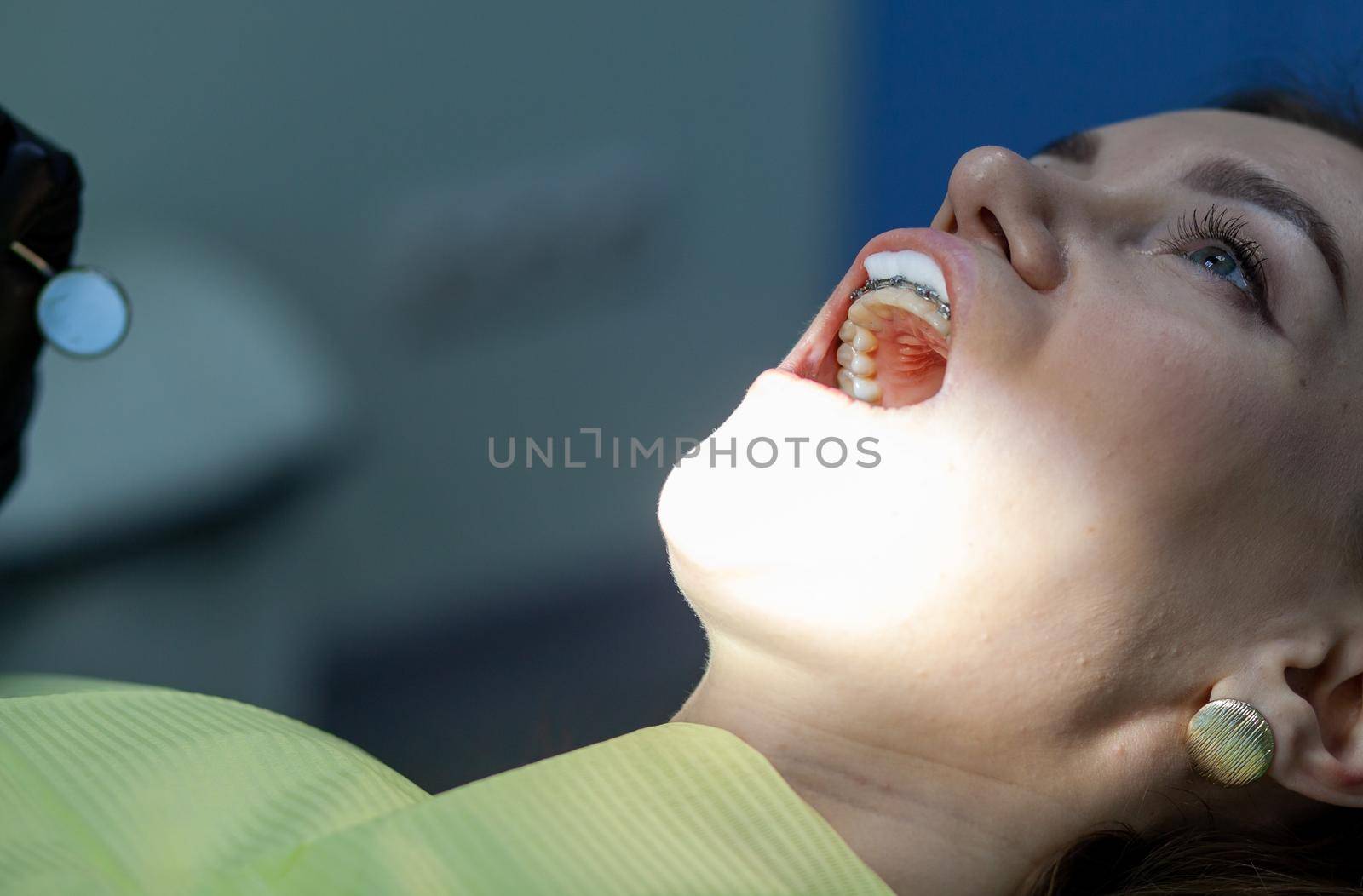 The process of removing braces.Beautiful woman in dental chair during procedure of installing braces to upper and lower teeth. Dentist and assistant working together, dental tools in their hands.