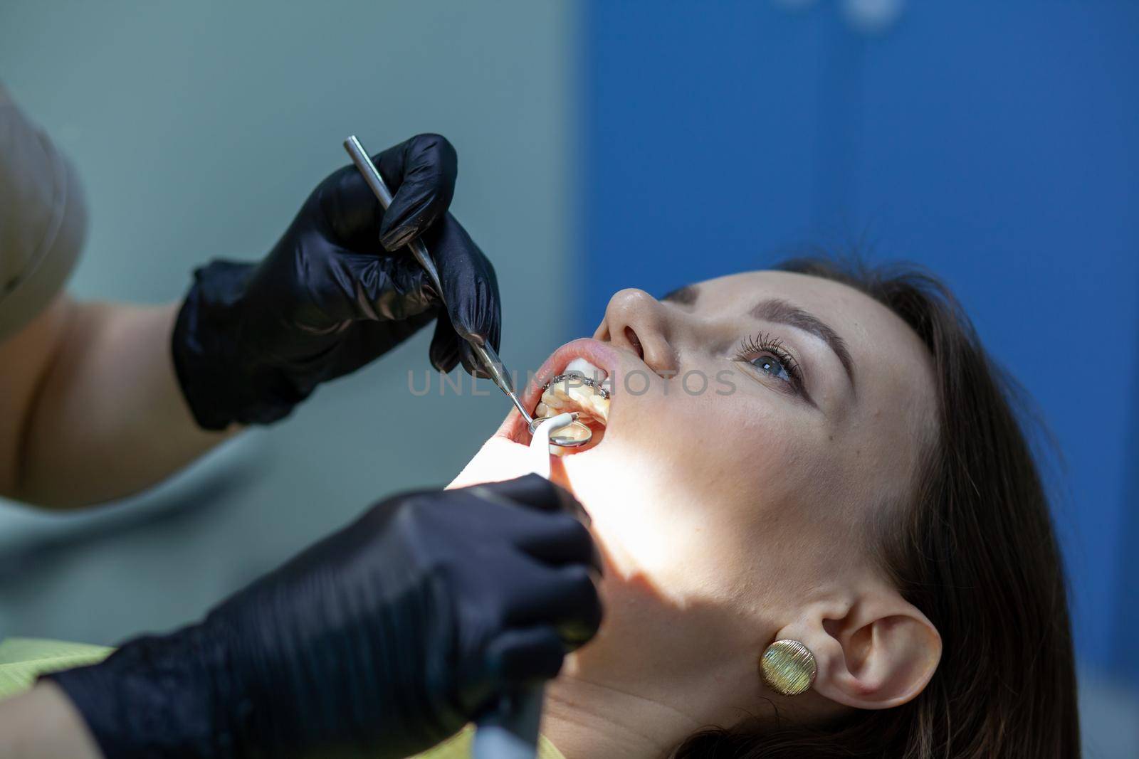 The process of removing braces.Beautiful woman in dental chair during procedure of installing braces to upper and lower teeth. Dentist and assistant working together, dental tools in their hands.