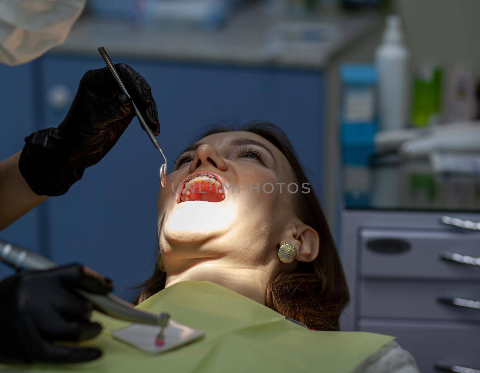 A woman at a dentist's appointment to replace arches with braces by AnatoliiFoto