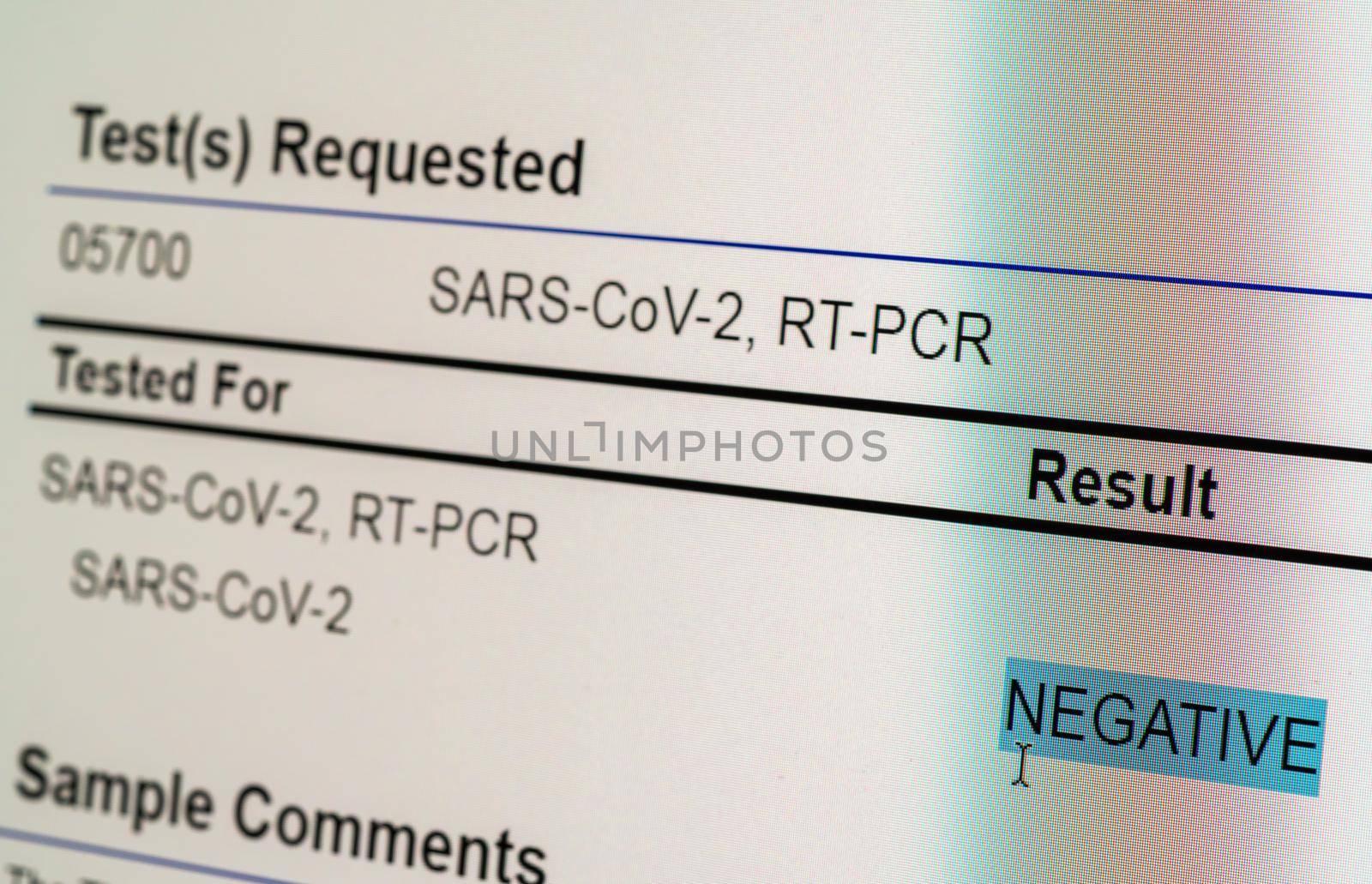 Computer screen showing a negative result for PCR test on nasal swab for SARS-CoV-2 or Covid-19