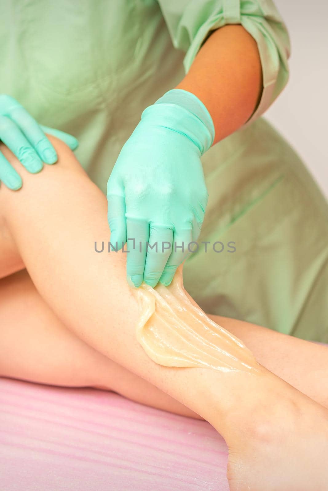 Sugaring legs. Woman legs hair removing. Hands in pink and blue rubber gloves of two beauticians apply sugar paste on female feet