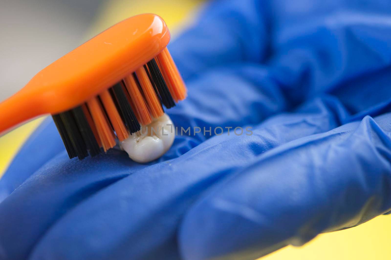 Tooth brush and deciduous milk child teeth on yellow background