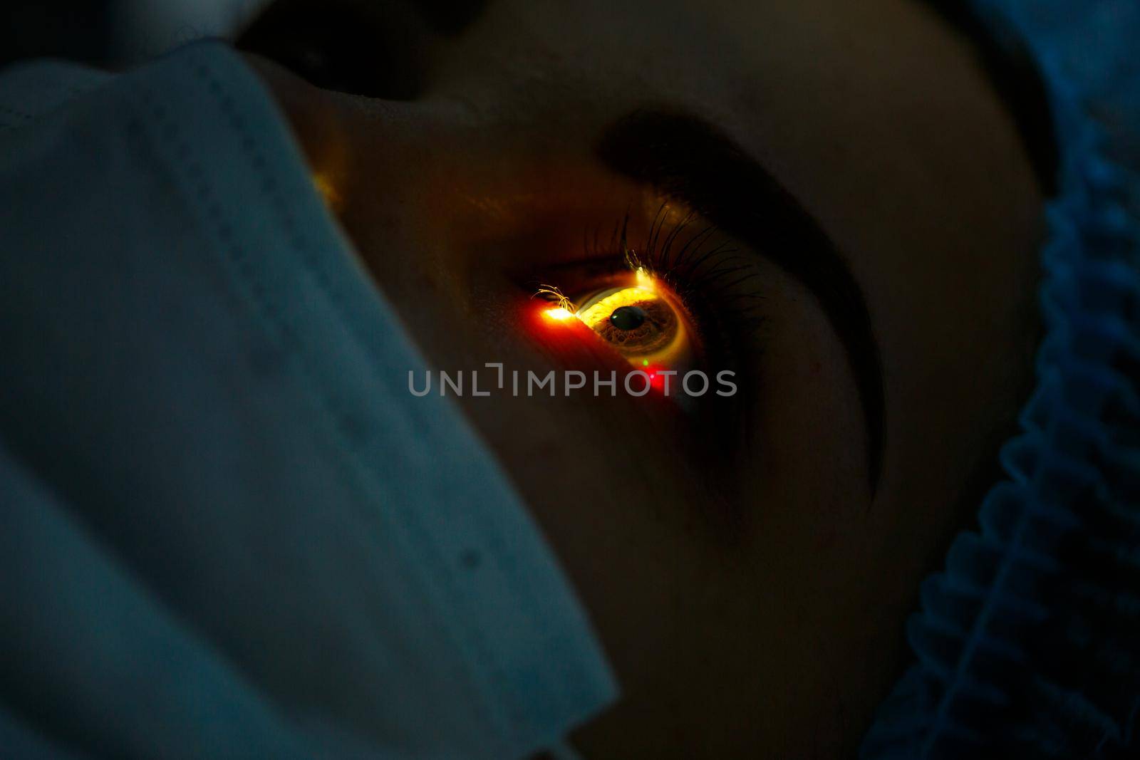 Medical laser eye correction. Medicine technology eye operation.