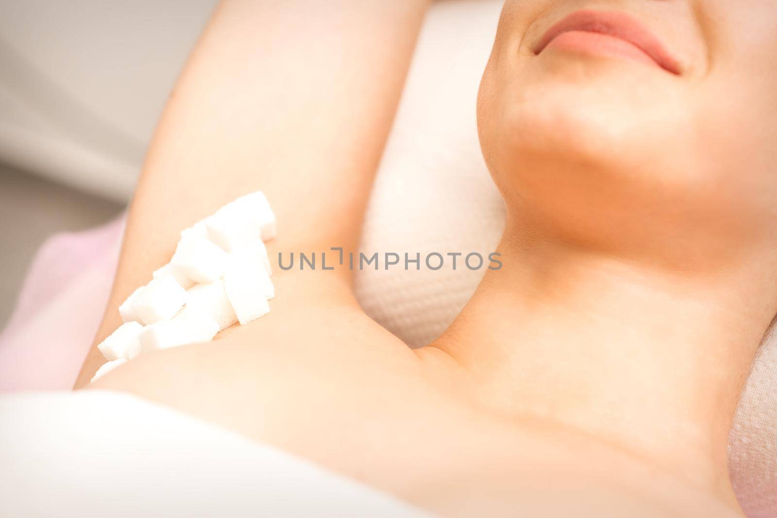 Sugaring, waxing concept. White sugar cubes lie down on the female armpit of the young white woman, close up