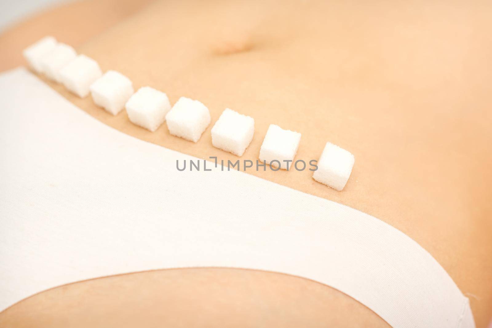 The concept of epilation, waxing, and intimate hygiene. Sugar cubes lying in a row on the bikini zone of a young white woman, close up. by okskukuruza