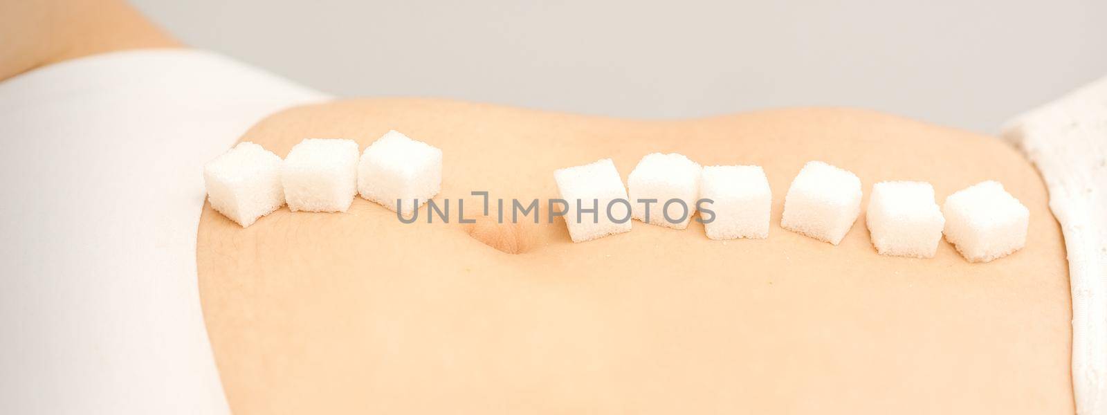 The concept of epilation, waxing. Sugar cubes lying in a row on the abdomen of a young white woman, close up. by okskukuruza