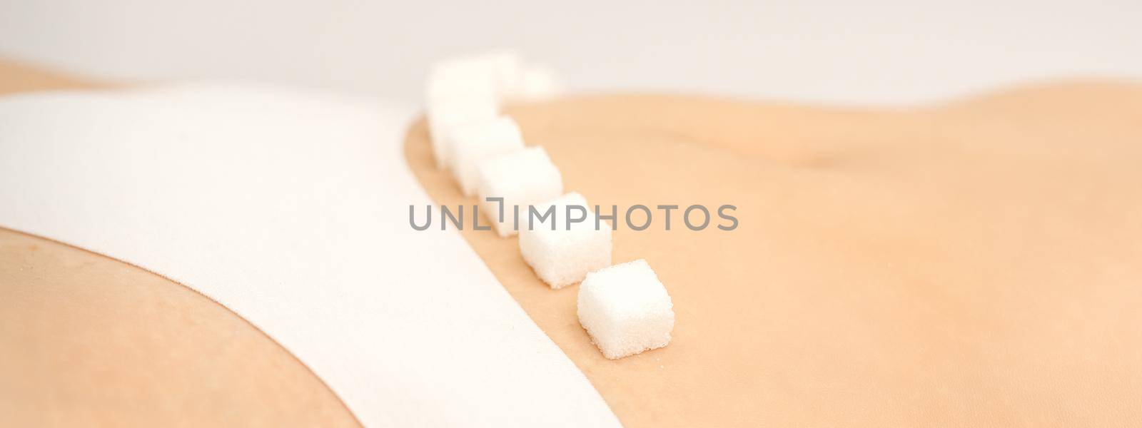 The concept of epilation, waxing, and intimate hygiene. Sugar cubes lying in a row on the bikini zone of a young white woman, close up
