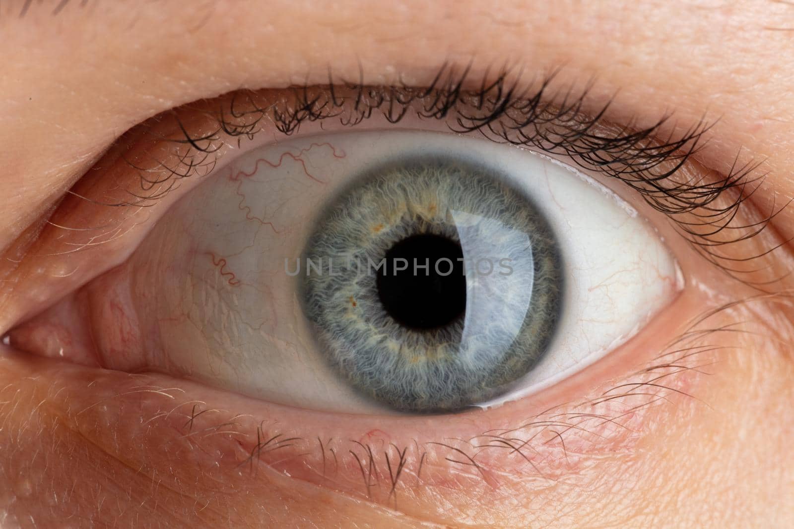 blue pupil close-up.