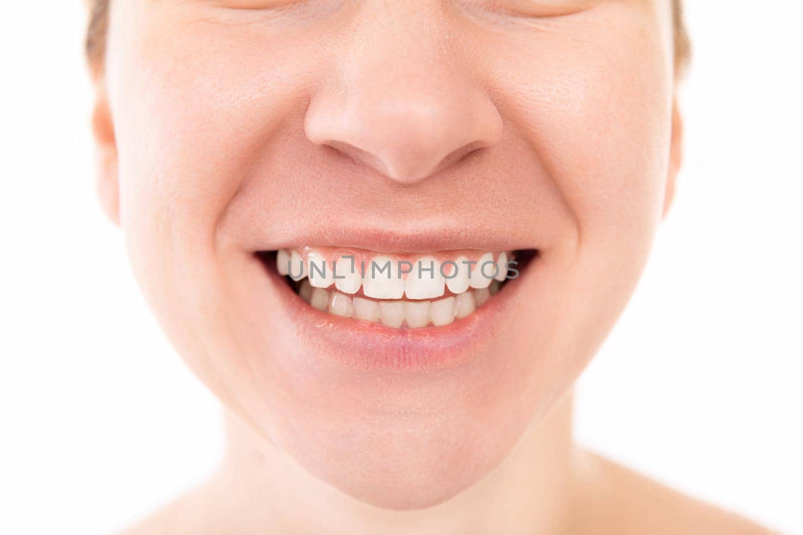 Wide smile with teeth close up, young woman portrait.