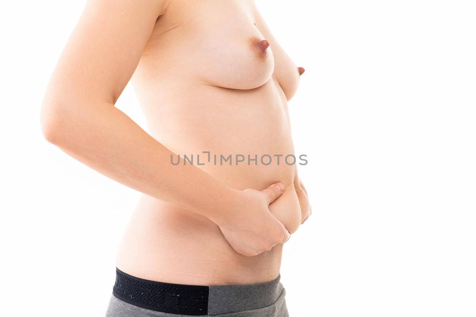 middle-aged woman after childbirth with folds in the abdomen.