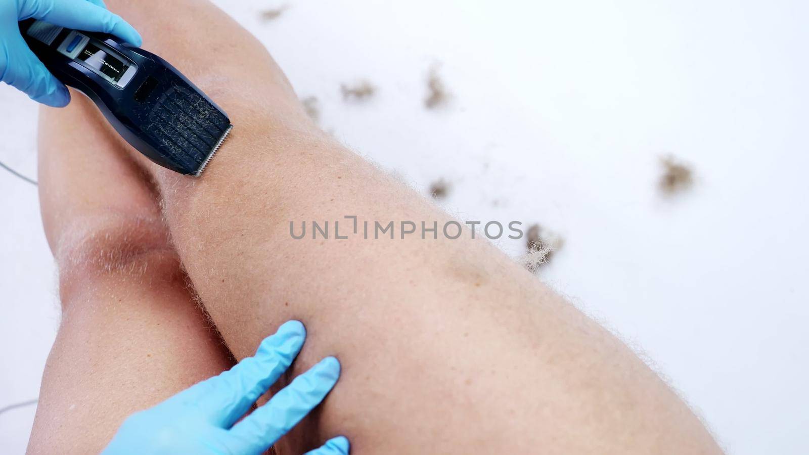 Close-up, cosmetologist female hands in gloves haircut body hair of a Naked hairy Man, his legs, whole body with a clipper, electric razor, trimer. on white background. High quality photo