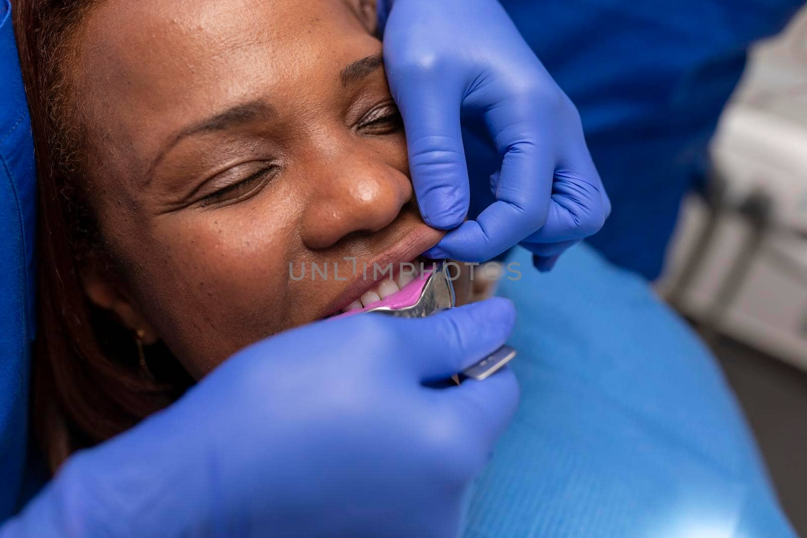 Close up view of a black woman patient being put on an impression tray inside her mouth at the dental clinic