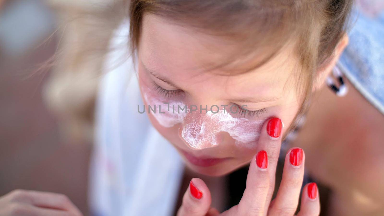 close-up, the child, girls, severe sunburn on the face. Mom smears places of burns abundantly with a special cream. Mother applying sun protection cream to her daughter face by djtreneryay