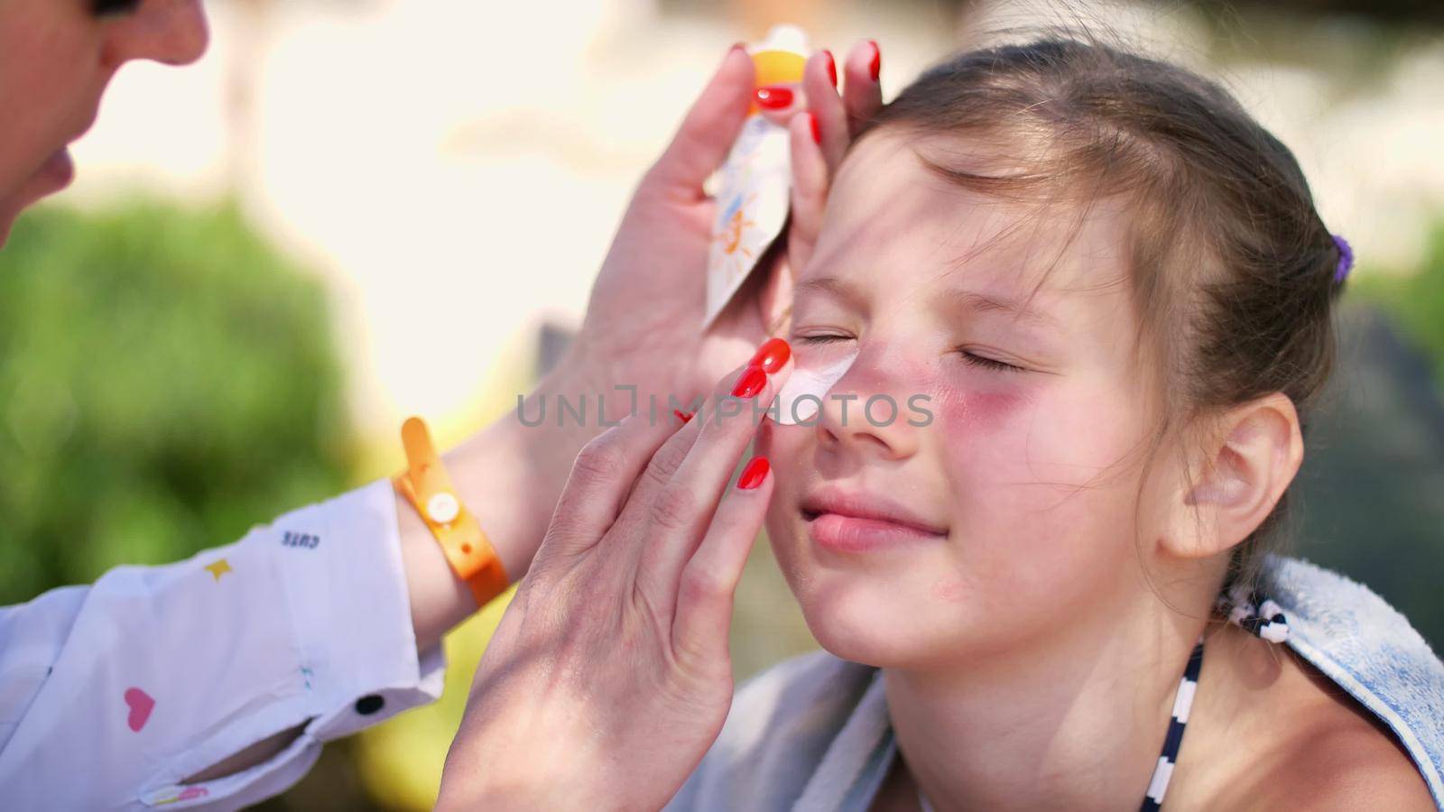 close-up, the child, girls, severe sunburn on the face. Mom smears places of burns abundantly with a special cream. Mother applying sun protection cream to her daughter face. High quality photo