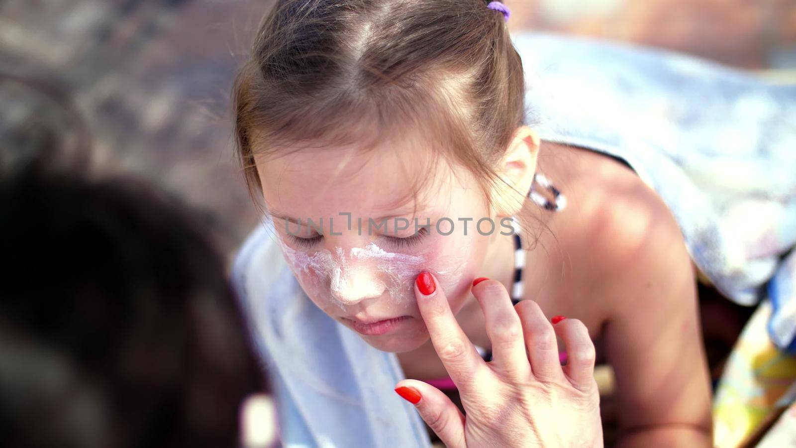 close-up, the child, girls, severe sunburn on the face. Mom smears places of burns abundantly with a special cream. Mother applying sun protection cream to her daughter face. High quality photo