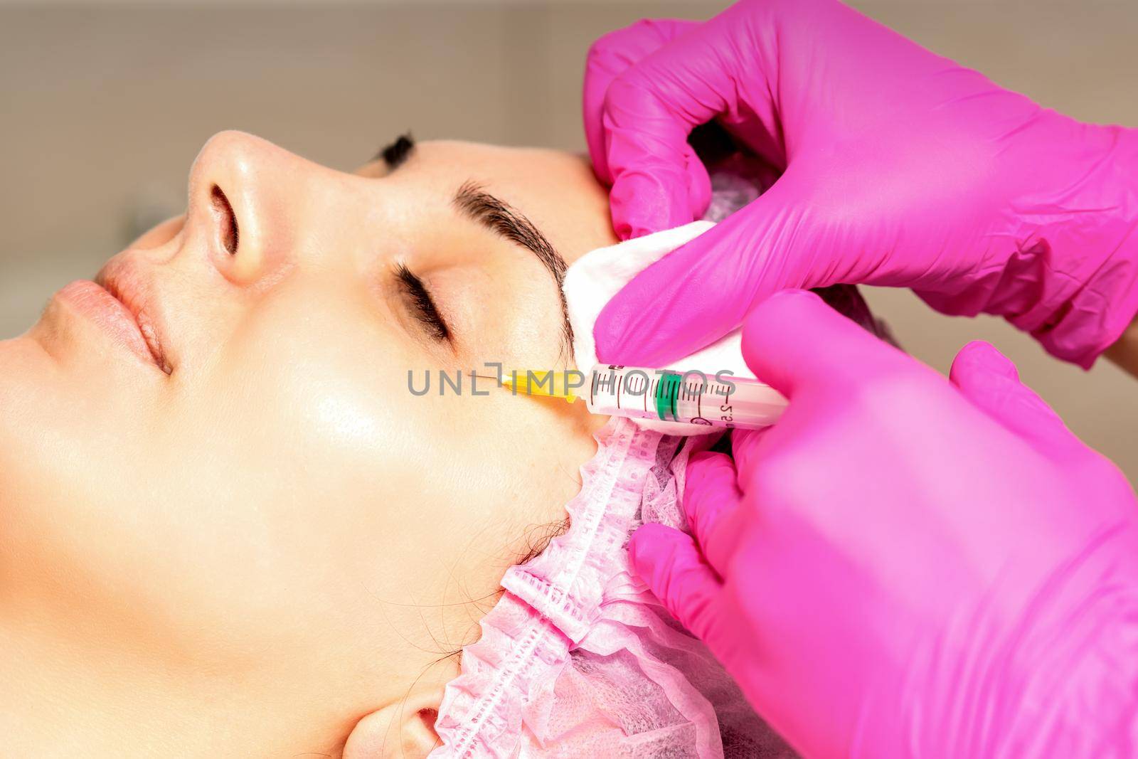 The young white woman is getting rejuvenating facial injections with hyaluronic acid on the eye in a beauty clinic