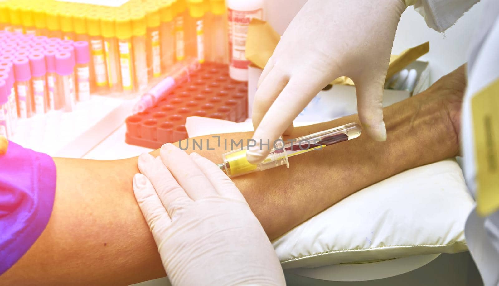 The laboratory assistant prepares blood for analysis for antibodies and viruses. Hand close up.