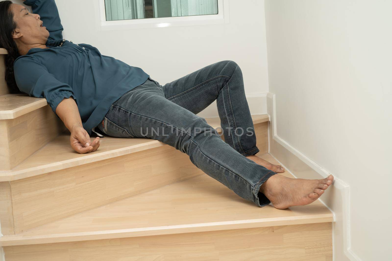 Asian lady woman patient fall down the stairs because slippery surfaces