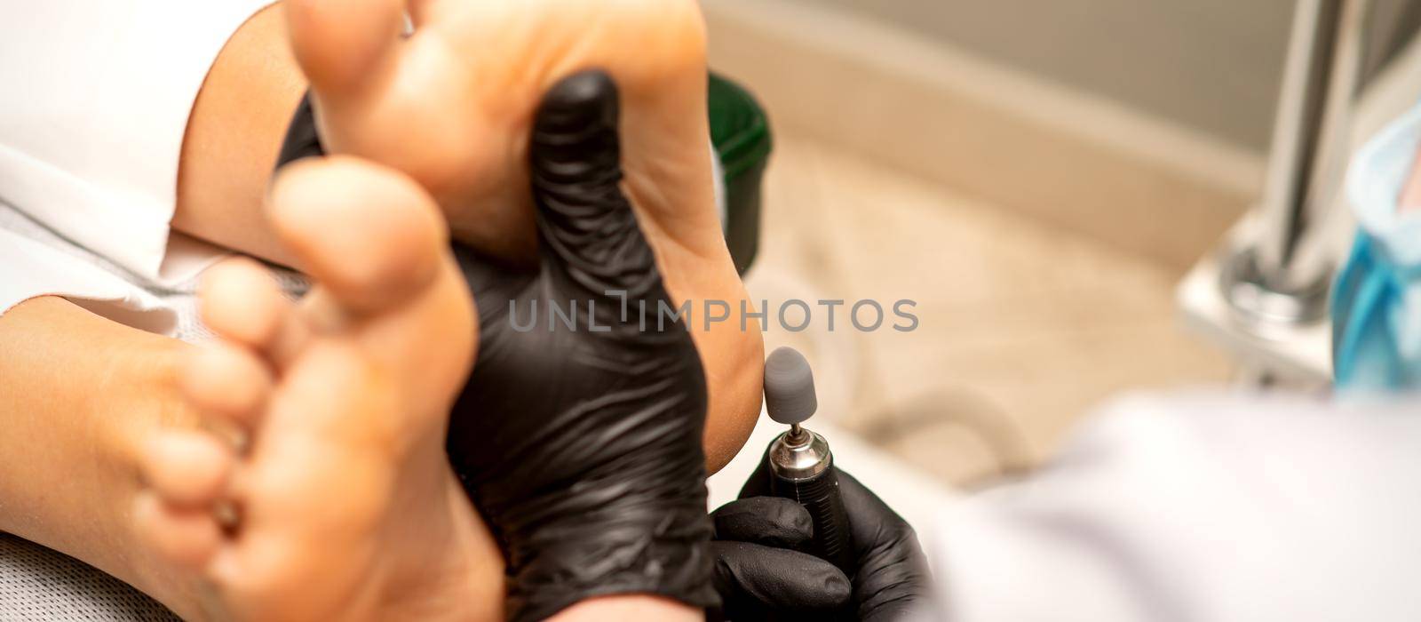 Podiatrist wearing black protective gloves cleaning the skin of foot from callus and corn with the professional electric tool
