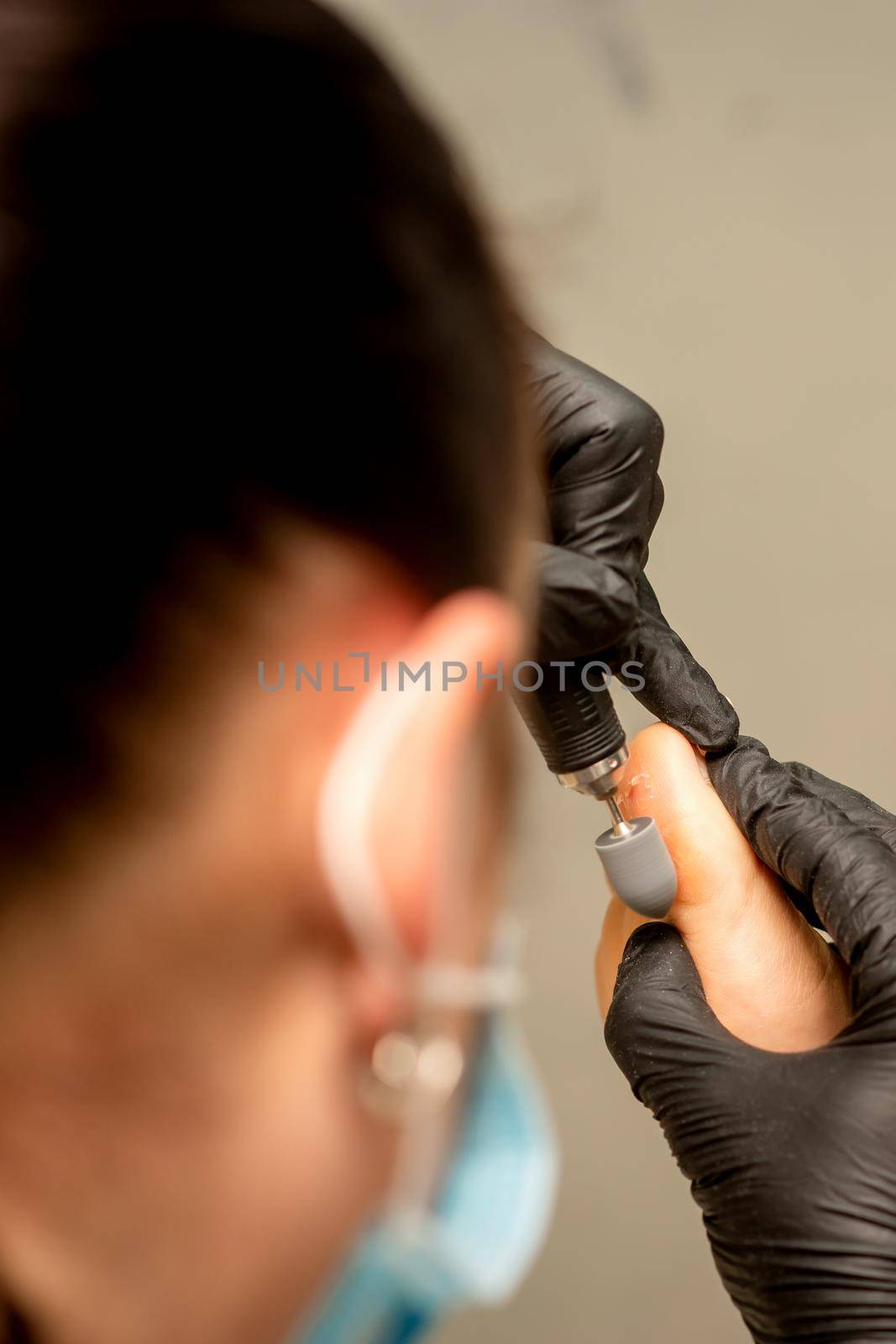 Podiatrist wearing black protective gloves cleaning the skin of foot from callus and corn with the professional electric tool