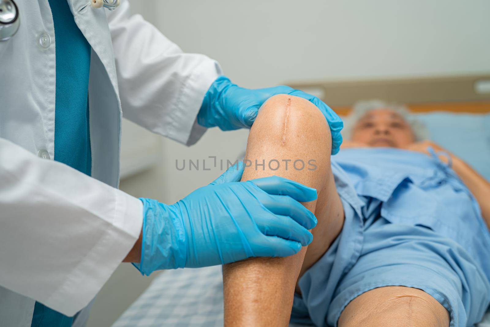 Doctor check Asian senior or elderly old lady woman patient scars surgical total knee joint replacement Suture wound surgery arthroplasty on bed in nursing hospital ward, healthy strong medical concept. by pamai