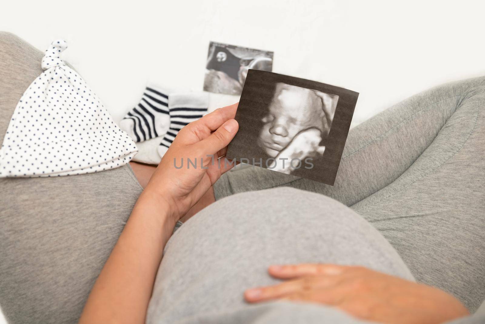 Pregnant woman holding 4D ultrasound image