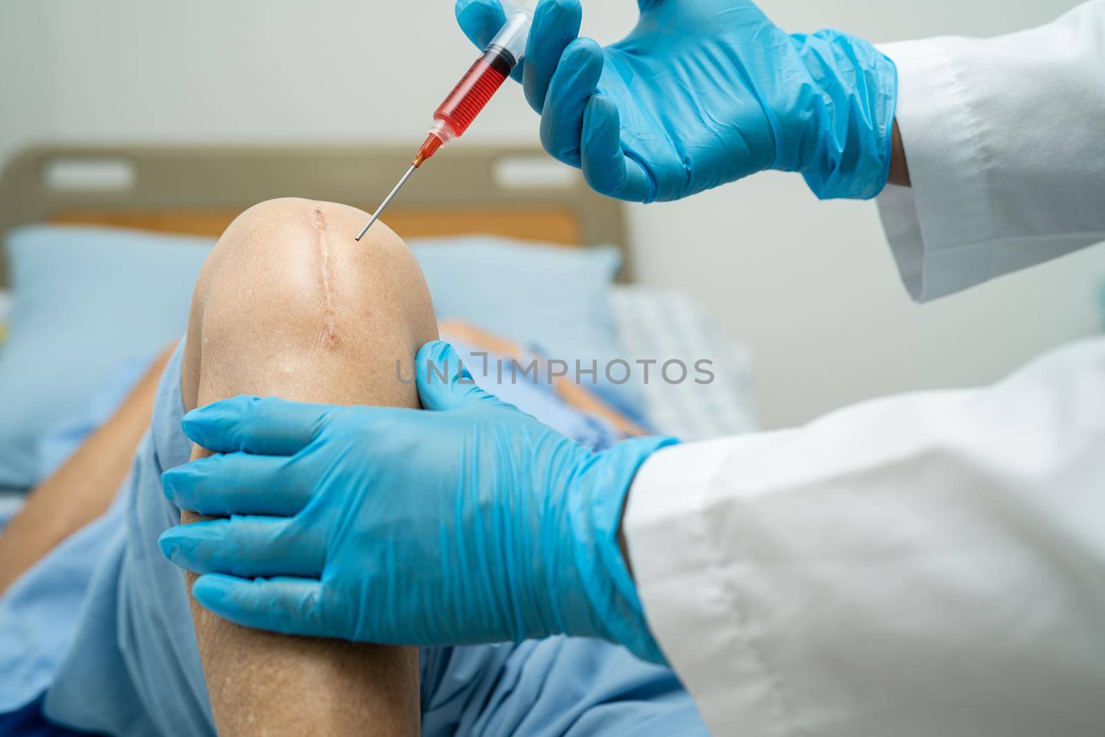 Asian doctor inject Hyaluronic acid platelet rich plasma into the knee of senior woman to walk without pain.