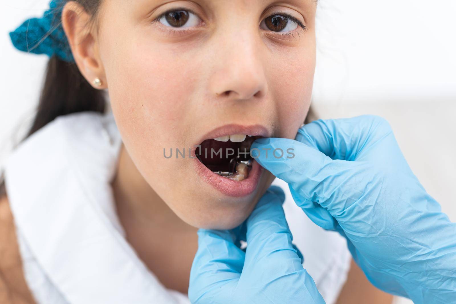 Dentist is check and set dimension of brackets. Talking to girl about braces in her mouth by Andelov13