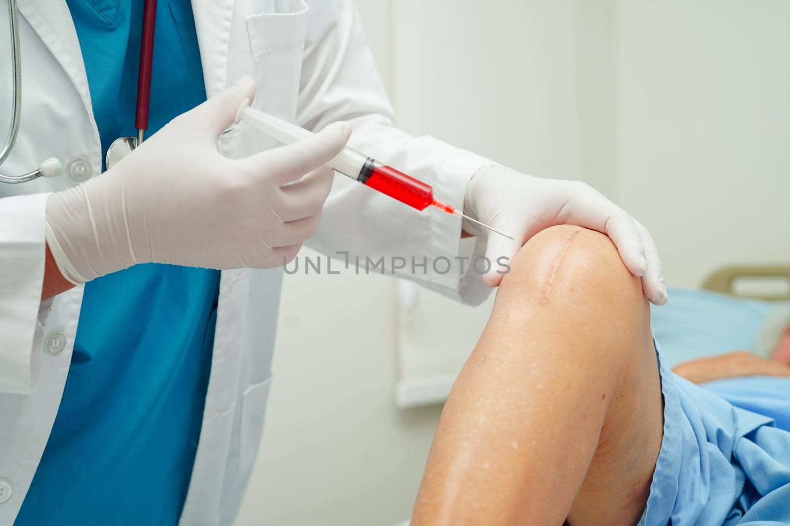 Asian doctor inject Hyaluronic acid platelet rich plasma into the knee of senior woman to walk without pain.