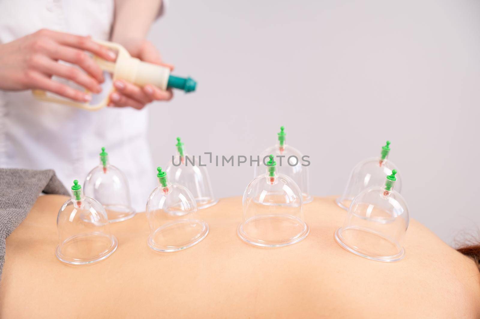 Female massage therapist uses vacuum cans on the patient's back