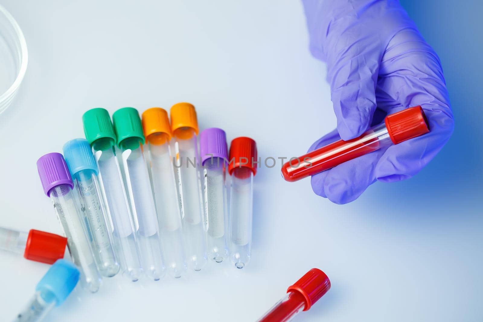 A medical professional, laboratory assistant, doctor performs an analysis in a laboratory, uses test tubes, a pipette and a petri dish for the presence of bacteria in the human body