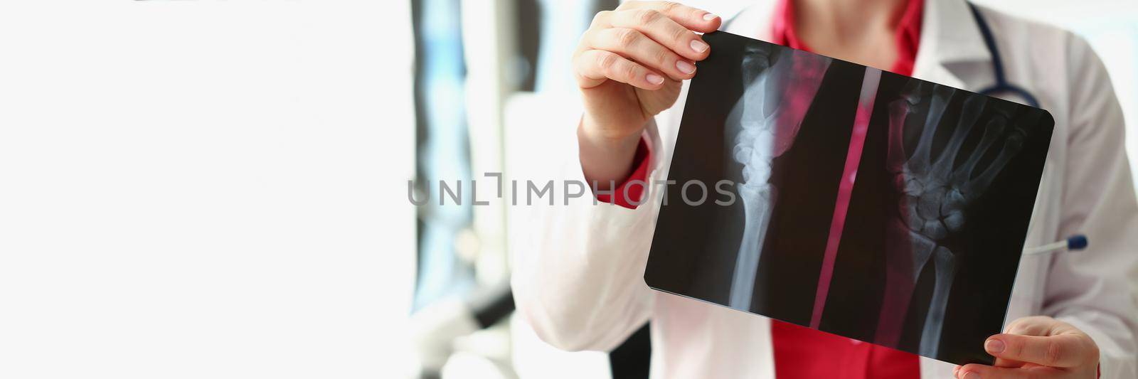 Close-up of medical worker analyzing patient hand xray result, injury. Specialist in uniform examine patient scan, prepare conclusion. Healthcare concept