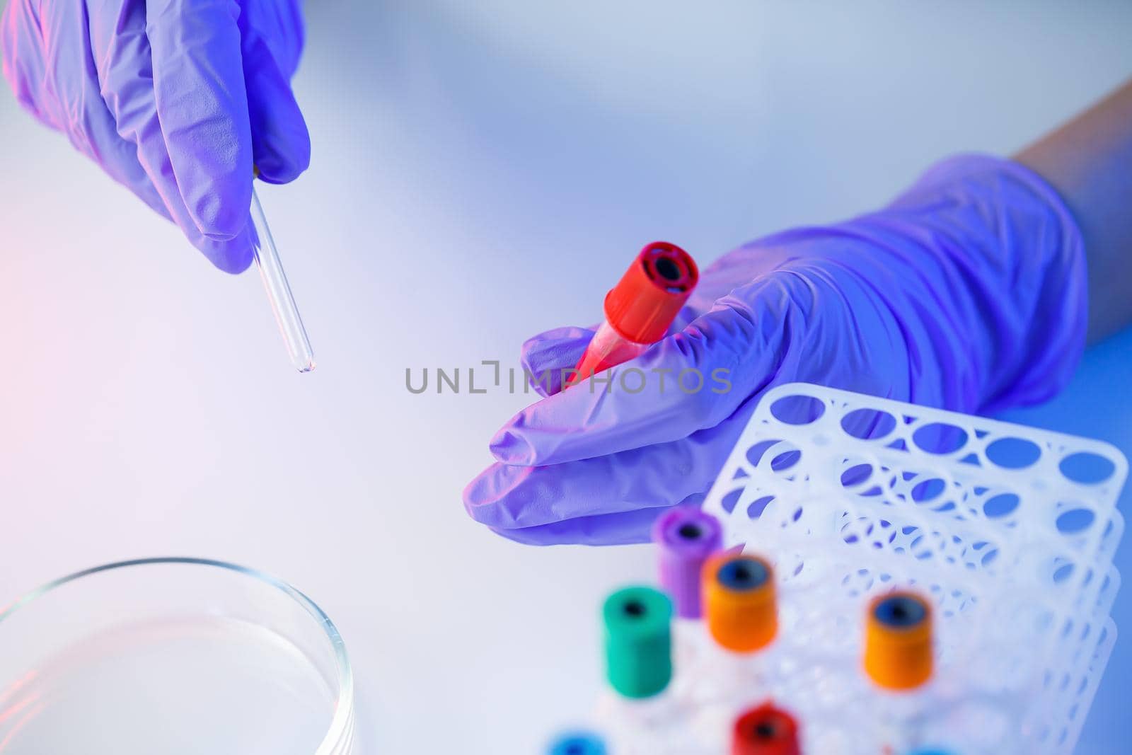 A medical professional, laboratory assistant, doctor performs an analysis in a laboratory, uses test tubes, a pipette and a petri dish for the presence of bacteria in the human body